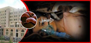 ارتفاع ضحايا الكوليرا إلى 1847 حالة ووفد اممي رفيع يزور اليمن