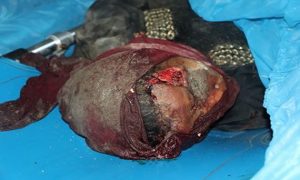 %d9%85%d8%ac%d8%b2%d8%b1%d8%a9-%d8%a7%d9%84%d8%b9%d8%af%d9%88%d8%a7%d9%86-%d8%a7%d9%84%d8%b3%d8%b9%d9%88%d8%af%d9%8a-%d9%81%d9%8a-%d8%a7%d9%84%d8%ad%d8%af%d9%8a%d8%af%d8%a9-2