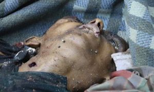 من ضحايا غارات العدوان السعودي على حي الهنود وسط مدينة الحديدة اليوم (المستقبل)